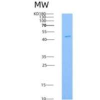 小鼠Axl激酶(Axl Kinase)重组蛋白