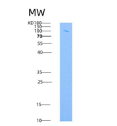 小鼠VCAM1 / CD106重组蛋白His & Fc ta