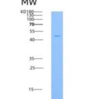 人CD98重组蛋白His Tag