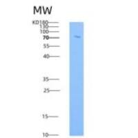 人基质金属蛋白酶9(MMP9)重组蛋白