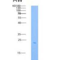 人ICAM-2 / CD102重组蛋白His tag