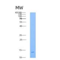 人血小板衍生生长因子B(PDGFB)重组蛋白His Tag