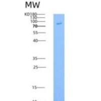 人OXSR1 / OSR1重组蛋白GST tag