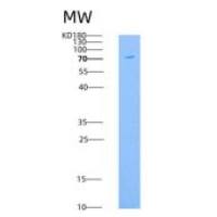 小鼠VCAM1 / L1CAM / CD106重组蛋白His tag