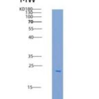 人BCL-W / BCL2L2重组蛋白His tag