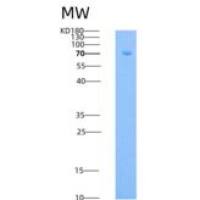 人E-Selectin / CD62e / SELE重组蛋白His & Fc tag