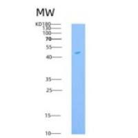 人ICAM-1 / CD54重组蛋白His tag