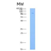 人MMP-9 / CLG4B重组蛋白His tag