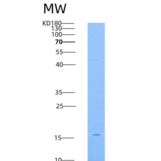 人TRAIL R2 / CD262 / TNFRSF10B重组蛋白His tag