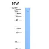 小鼠VCAM1 / CD106重组蛋白His & Fc tag