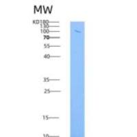 小鼠VCAM1 / CD106重组蛋白His & Fc tag