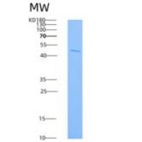 大鼠IL4R / Il4ra重组蛋白Fc tag