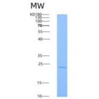 人Ras同源基因家族成员A(RHOA)重组蛋白His tag