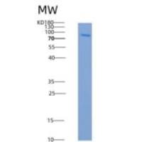人EphB3 / HEK2重组蛋白aa 585-998, His & GST tag