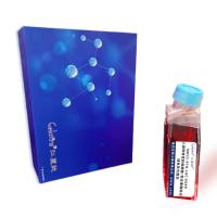 MHCC-97H-LUC-EGFP/人高转移性肝癌细胞-荧光素酶标记