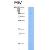 小鼠白三烯A4水解酶(LTA4H)重组蛋白His tag
