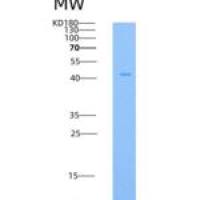 小鼠半乳糖苷酶α(GLa)重组蛋白His tag