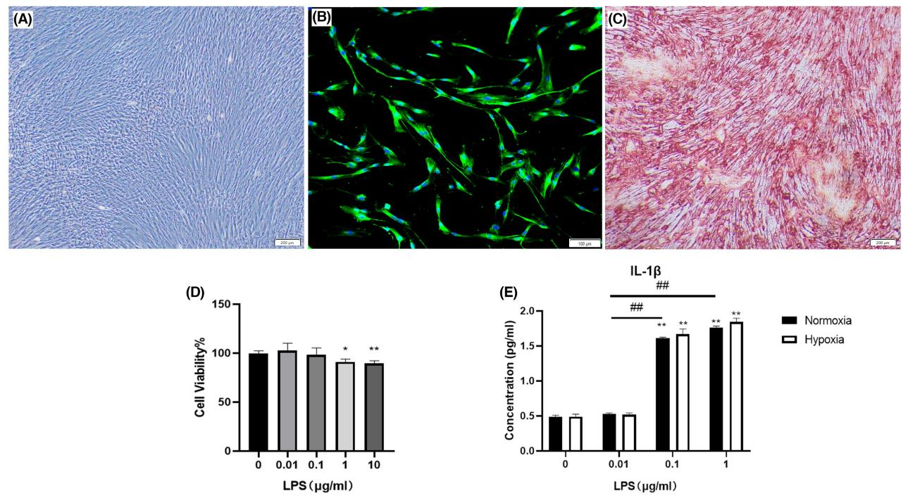 文献解读——低氧与牙周韧带细胞研究