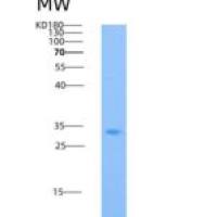 小鼠IL2RG / CD132重组蛋白His tag