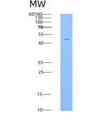 人GFRA1 / GFRα1 / GDNFRA重组蛋白His