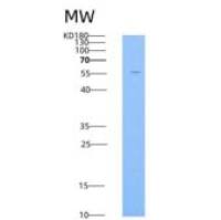 小鼠CD146 / MCAM重组蛋白His tag