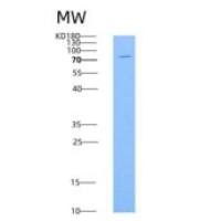 人E-Cadherin重组蛋白His Tag