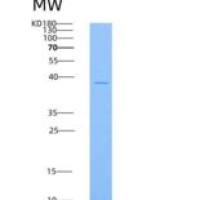 小鼠分泌型卷曲相关蛋白4(SFRP4)重组蛋白His tag