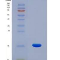 人CASP7 / caspase 7 / MCH3重组蛋白His tag