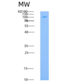 人EPOR & CD131 Homodimer重组蛋白