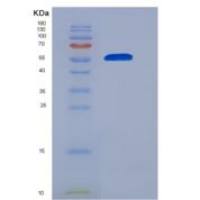 大鼠叶酸受体1(FOLR1)重组蛋白Fc tag