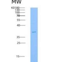 人IL5Ra / CD125重组蛋白His tag