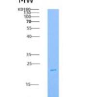 人TIM-3 / HAVCR2重组蛋白His tag
