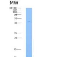小鼠ALK-3 / BMPR1A重组蛋白His & Fc tag