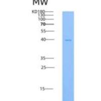 小鼠FGFR4 / CD334重组蛋白His tag