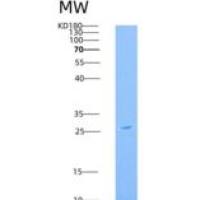 小鼠ICOS Ligand / B7-H2 / ICOSLG重组蛋白His tag