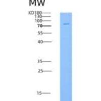 人Lyn Kinase重组蛋白GST tag