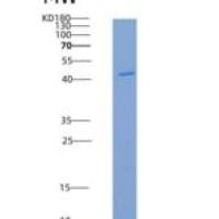 人葡萄糖激酶(GCK)重组蛋白