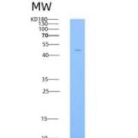 大鼠Syndecan-1 / SDC1 / CD138重组蛋白Fc tag