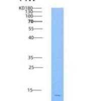 人HIST3H2A / Histone H2A重组蛋白