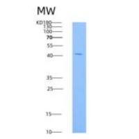 小鼠HVEM / TNFRSF14重组蛋白His & Fc tag