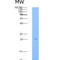 大鼠Syndecan-1 / SDC1 / CD138重组蛋白His tag