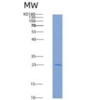 小鼠B7-1重组蛋白His Tag