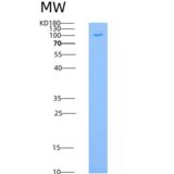 人EPOR & CD131 Homodimer重组蛋白