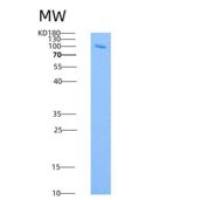 人ANPEP / CD13重组蛋白603 Met/Ile, His tag