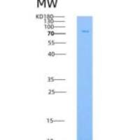 人Lck Kinase重组蛋白GST tag