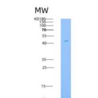 小鼠GFRA1 / GFR alpha-1重组蛋白His tag