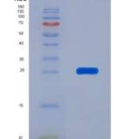 小鼠BH3相互作用域死亡激动剂(Bid)重组蛋白