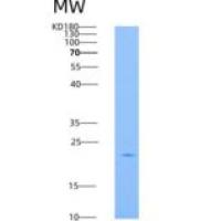 人基质细胞衍生因子2(SDF2)重组蛋白His tag