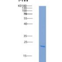 人腺苷酸激酶1(AK1)重组蛋白His tag