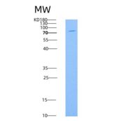 人E-Cadherin重组蛋白His Tag